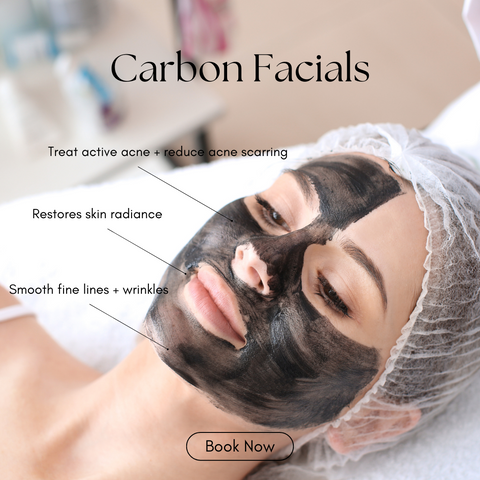 Carbon Facial